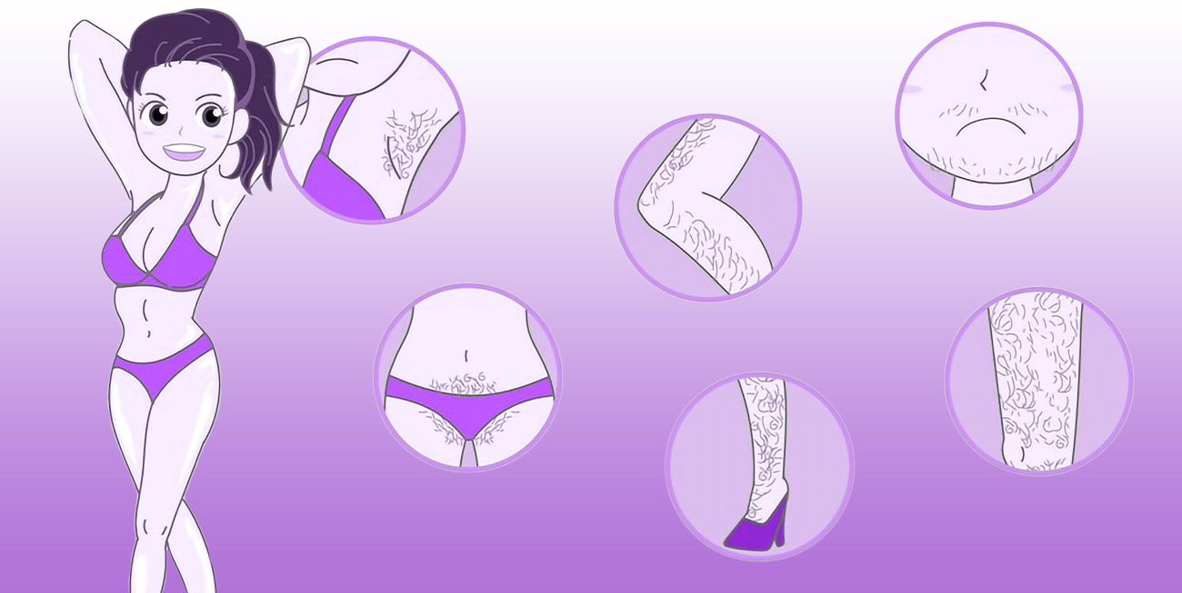 image here