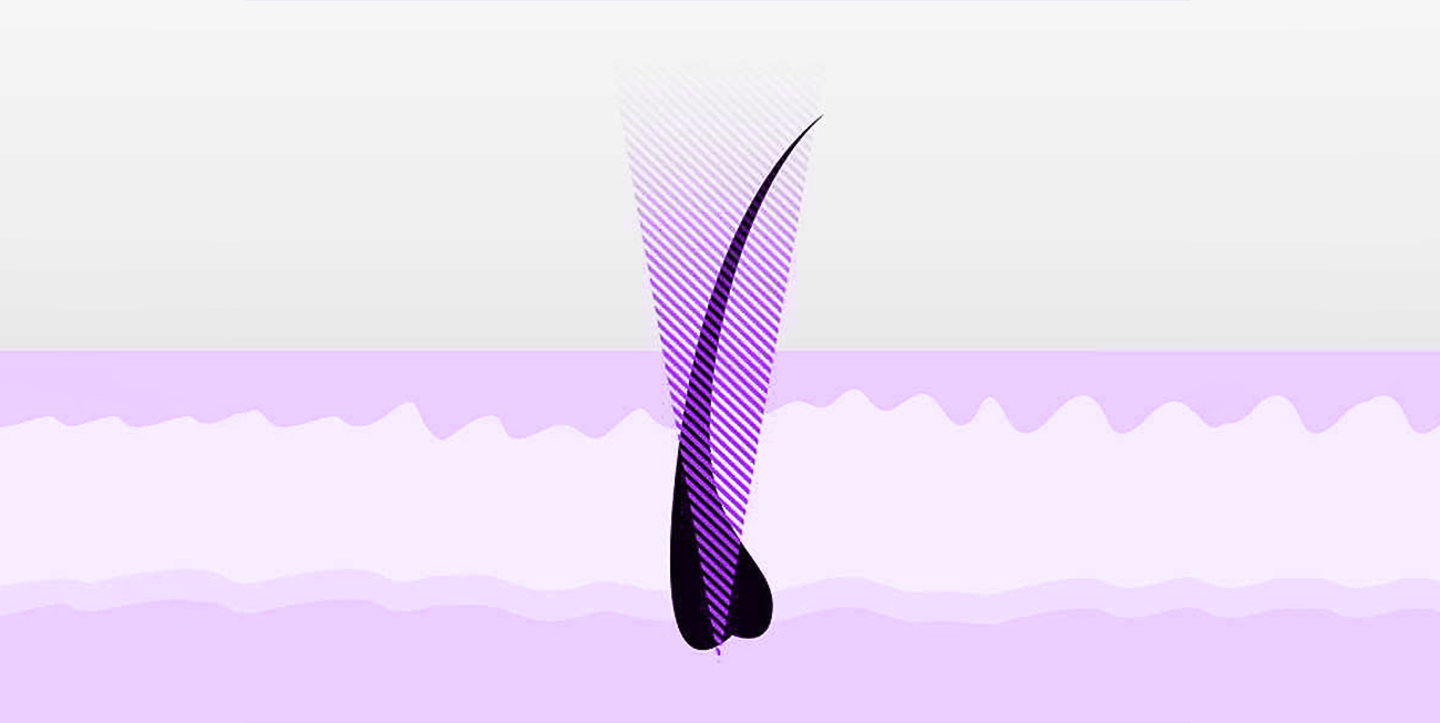 image here