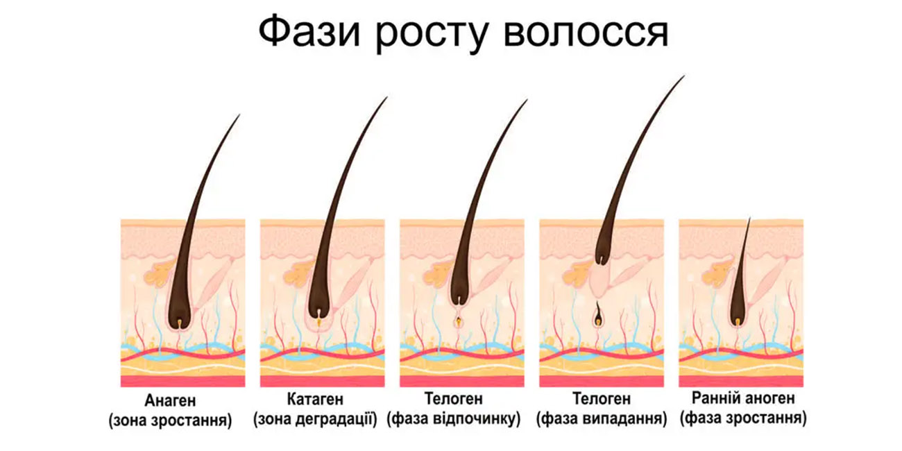 image here